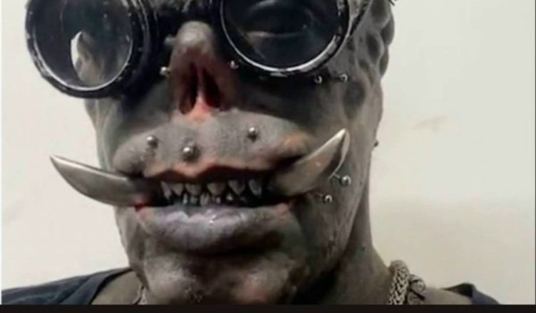 Мишел «Диабан» Праддо считается одним из самых изменённых людей на планете.