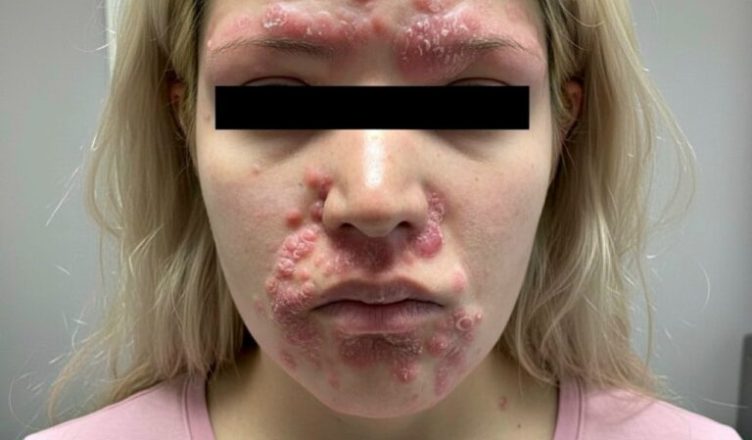 Вот к чему приводит сон/близость с…