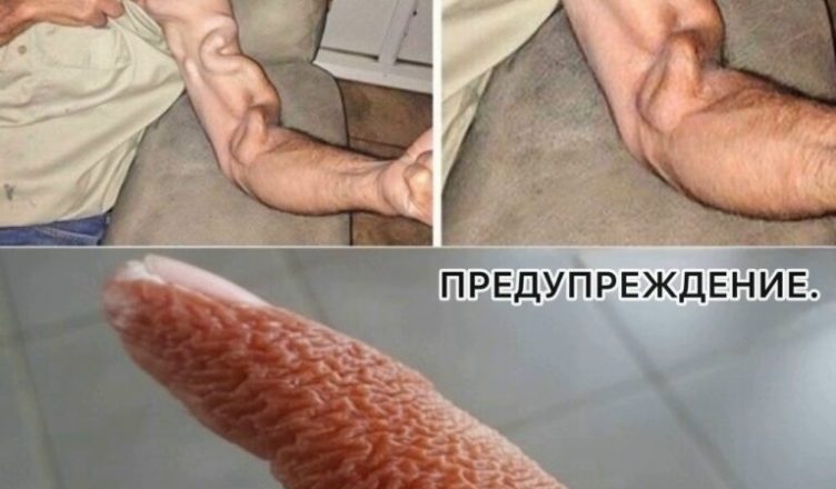 Мужчина потянулся и внезапно ощутил резкую боль в руке, это был ра…