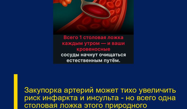 Закупорка артерий может тихо увеличить риск инфаркта и инсульта — но всего одна столовая ложка этого природного средства каждое утро помогает сохранить сосуды чистыми и крепкими.