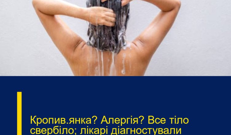 Кропив’янка? Алергія? Все тіло свербіло; лікарі діагностували найгірше.