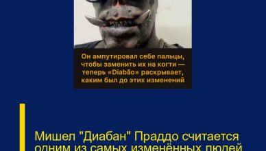Мишел «Диабан» Праддо считается одним из самых изменённых людей на планете.