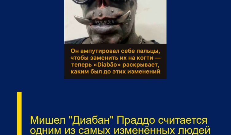 Мишел «Диабан» Праддо считается одним из самых изменённых людей на планете.