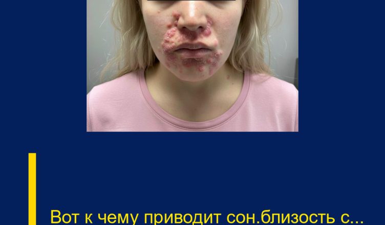 Вот к чему приводит сон/близость с…