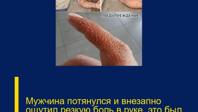 Мужчина потянулся и внезапно ощутил резкую боль в руке, это был ра…