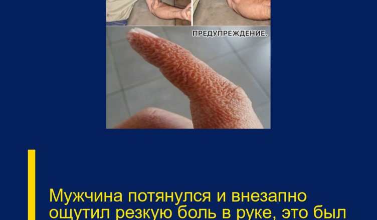 Мужчина потянулся и внезапно ощутил резкую боль в руке, это был ра…