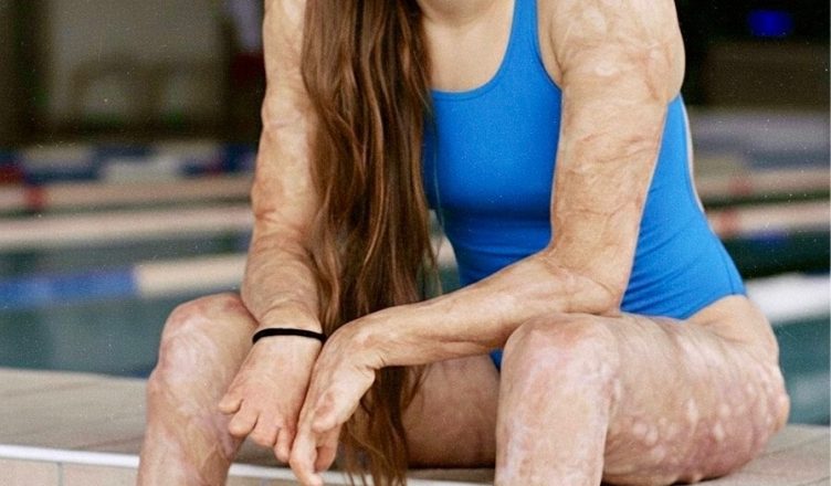 Вот к чему может привести интимная связь с…