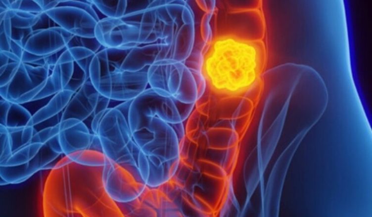 Она предупреждает всех: если вы замечаете у себя похожие симптомы, *немедленно обратитесь к врачу**.