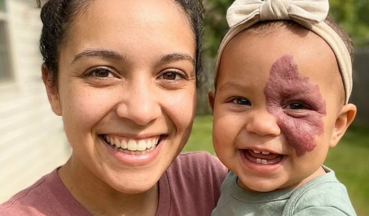 Её маленькую дочь похитили, а спустя 18 лет она вдруг увидела на обложке журнала девушку с таким же родимым пятном