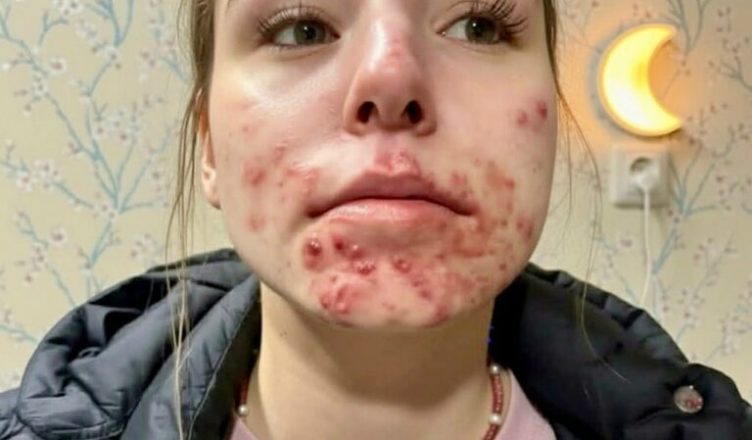 Вот что происходит, когда вы спите с…