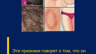 Эти признаки говорят о том, что он кр…