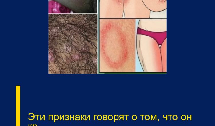 Эти признаки говорят о том, что он кр…