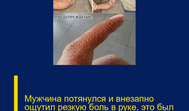 Мужчина потянулся и внезапно ощутил резкую боль в руке, это был ра…