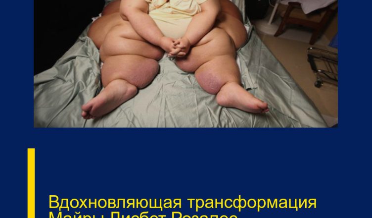 Вдохновляющая трансформация Майры Лисбет Розалес