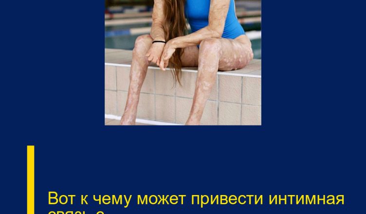 Вот к чему может привести интимная связь с…