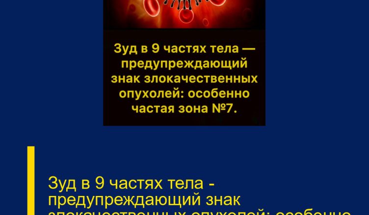 Зуд в 9 частях тела — предупреждающий знак злокачественных опухолей: особенно частая зона №7